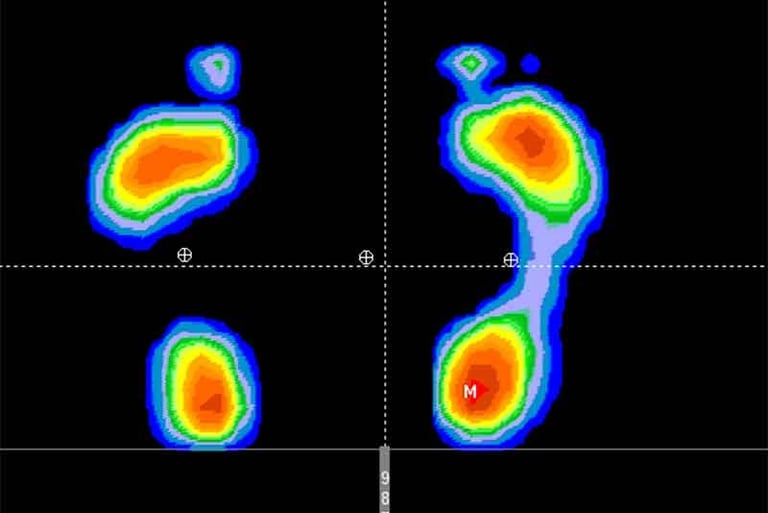 plantillas estudio de la marcha illescas