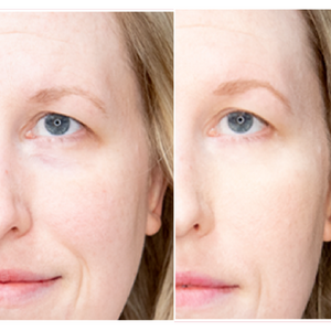 Lifevantage Collagen Before and After Results - woman face