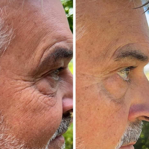 Lifevantage Collagen Before and After Results - man face