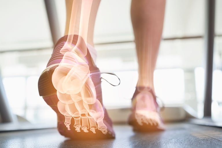 a person walking on a treadmill with a foot on a tread