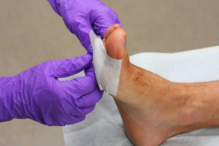 CURACION DE HERIDAS