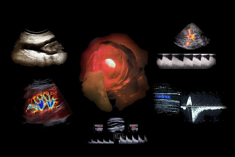 Diagnostic medical ultrasound scans showing internal organ imaging and blood flow Doppler results.