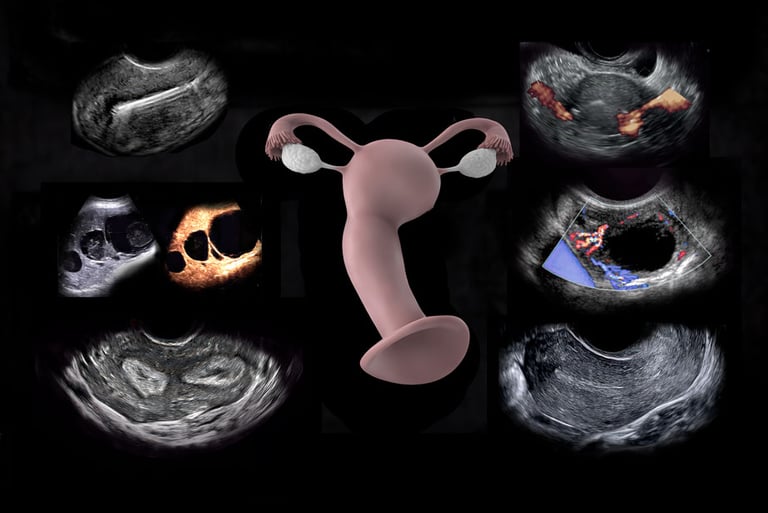 Anatomy model of the uterus and ovaries surrounded by ultrasound images of same.