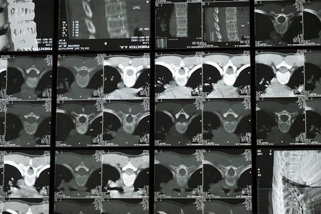 ct scan dataset