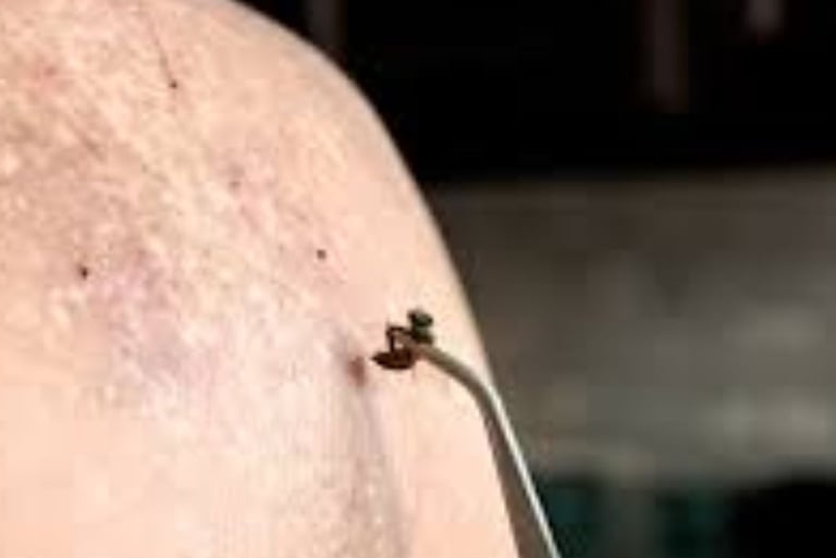 Bee Therapy  the Benefits and Uses of Bee Venom (6)