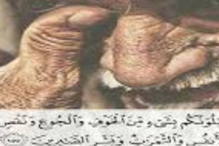 الموت أو فقدان الثروة