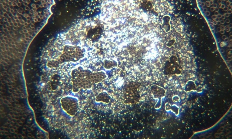 Image: large sphere with microrobots forming dense material with encased red blood cells used as an 