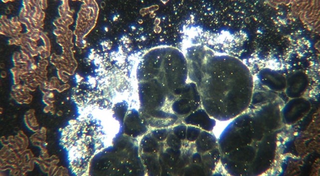 Image: Many spherical dark self-assembly sites with surrounding micro robots that conglomerate into 