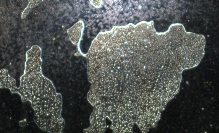 Image: construction sites filled with smaller spheres, all of which can grow more filaments and hydr
