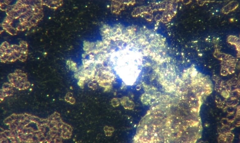 Image: different states of construction of solid hydrogel with red blood cells in rouleaux and oxida