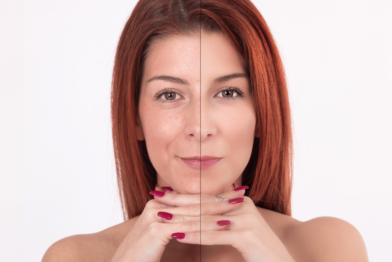 Anti-Aging Treatments