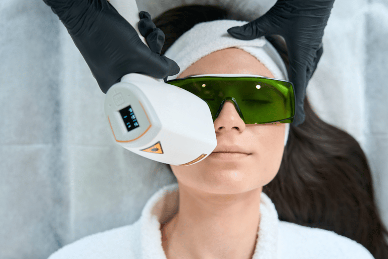 Laser Hair Removal