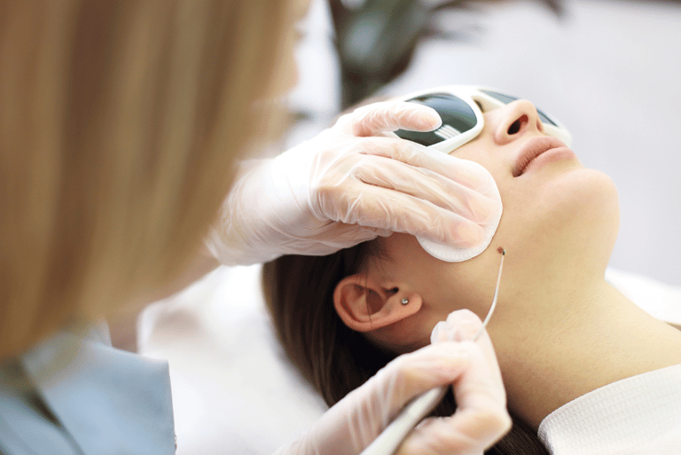 Mole and Skin Tag Removal