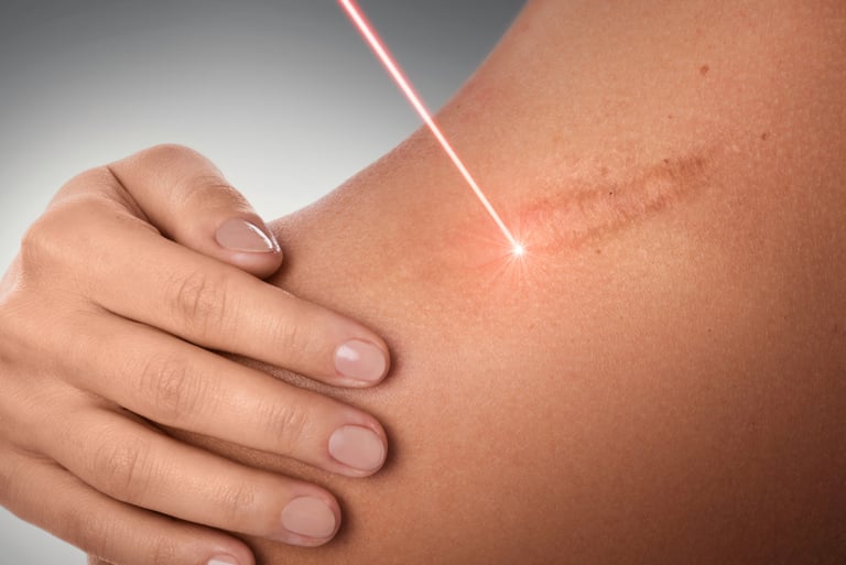 Scar Revision and Treatment