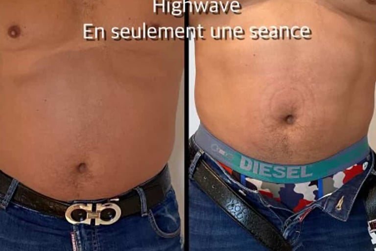avant apres
