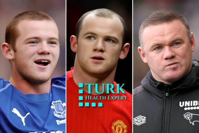 footballer Wayne Rooney hair transplant