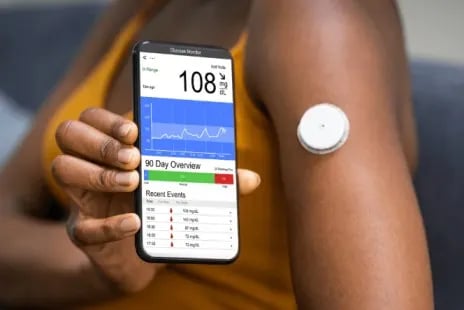 Patient wearing continuous glucose monitoring system (CGMS) sensor at Madinaguda, Hyderabad