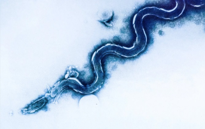 syphilis