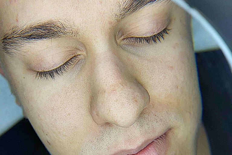 Arckezelés előtti állapot Veszprémben