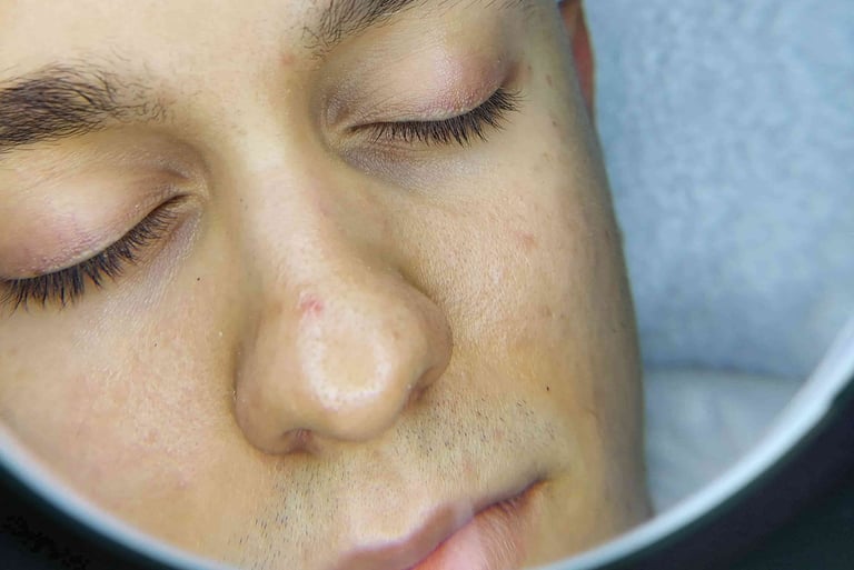 Arckezelés utáni bőr Veszprém