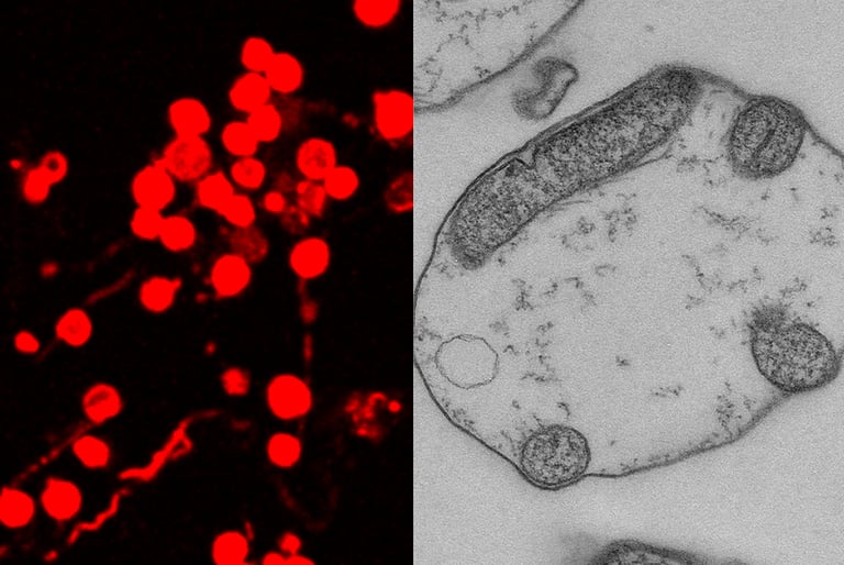 Foto de borrelia en su forma persistente