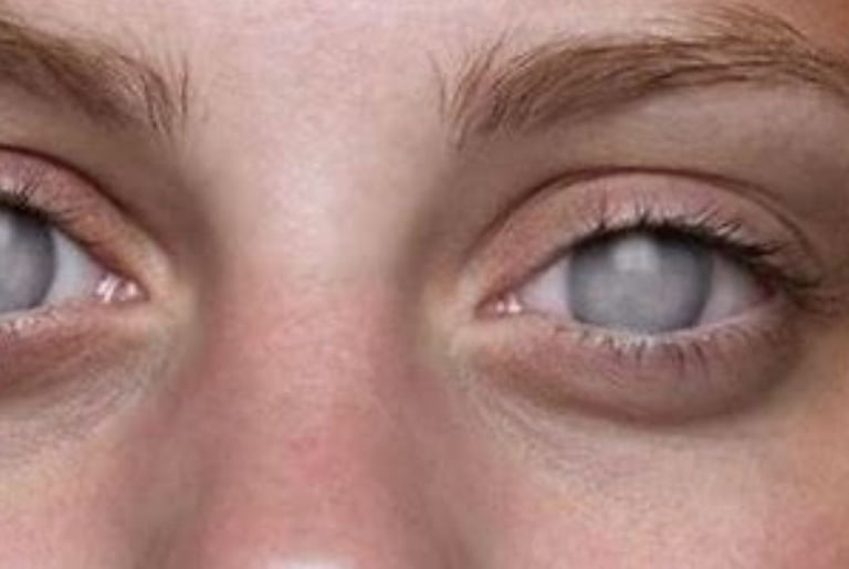 blindness