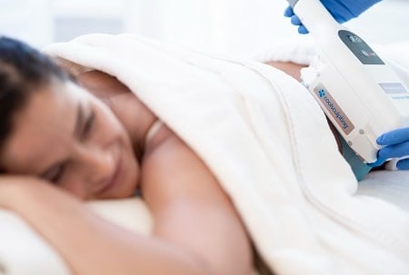 coolsculpting criolipolisis