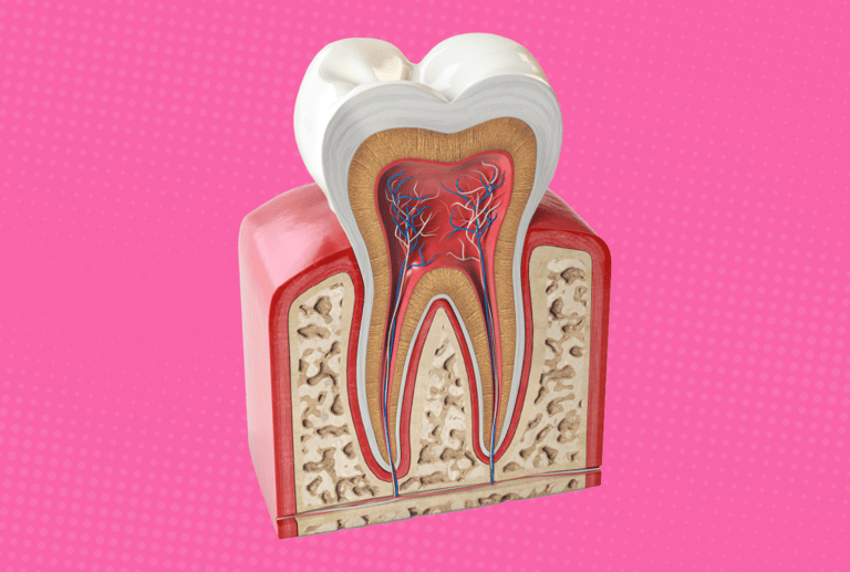 a image showing tooth with inner layers dentin and pulp