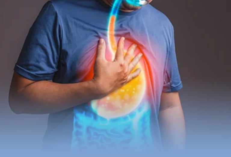 imagem que representa refluxo gastroesofágico