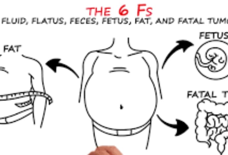 انتفاخ البطن : مجموعة متنوعة من العلاجات the 6 fs