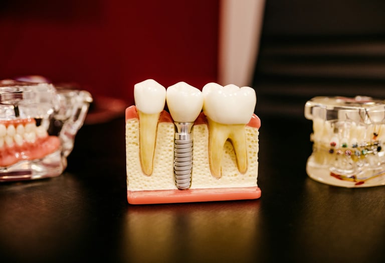 Zahnimplantate Türkei — Straumann Implantat Beratung bei Designed Smiles İzmir
