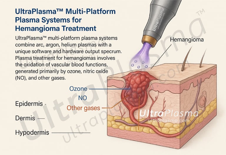 _ultra_plasma_ultra_plazma_ultra-plasma_ultra-plazma