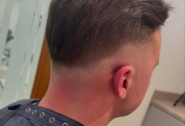 After hybrid hair loss system Hull hairlabuk