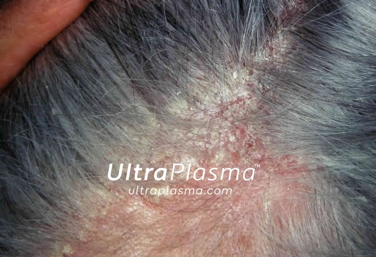 _ultra_plasma_ultra_plazma_ultra-plasma_ultra-plazma