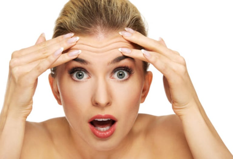 Botox para eliminar arrugas en frente, entrecejo y patas de gallo.