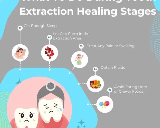 the dentist office at berea extraction greenville SC