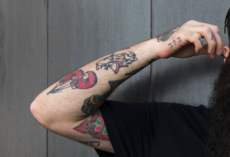 cabinet perma medical : détatouage