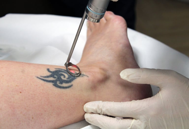 a person with a tattoo on their arm