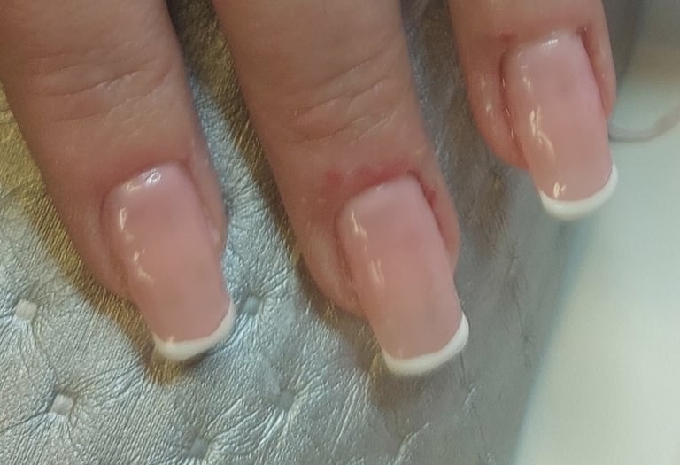 Behandling med tippar & Fransk