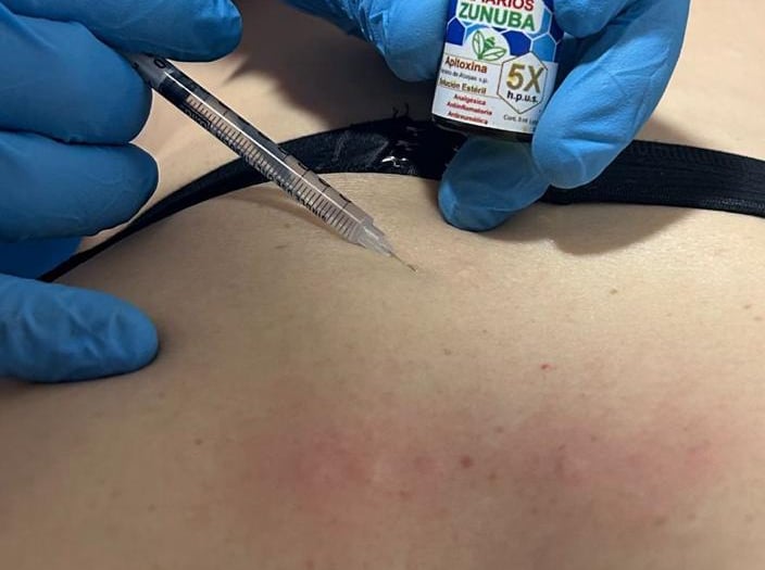 Reacción alérgica y efectos tóxicos del veneno de abeja