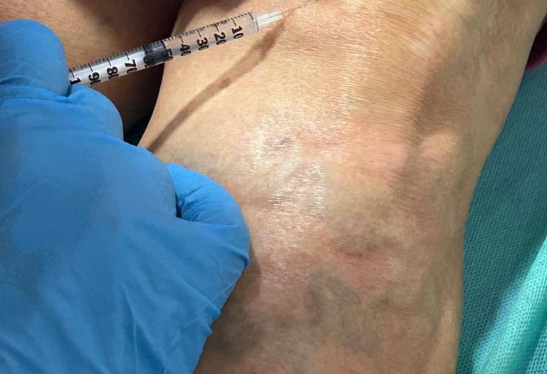 Protocolo de Aplicación de Apitoxina Inyectable