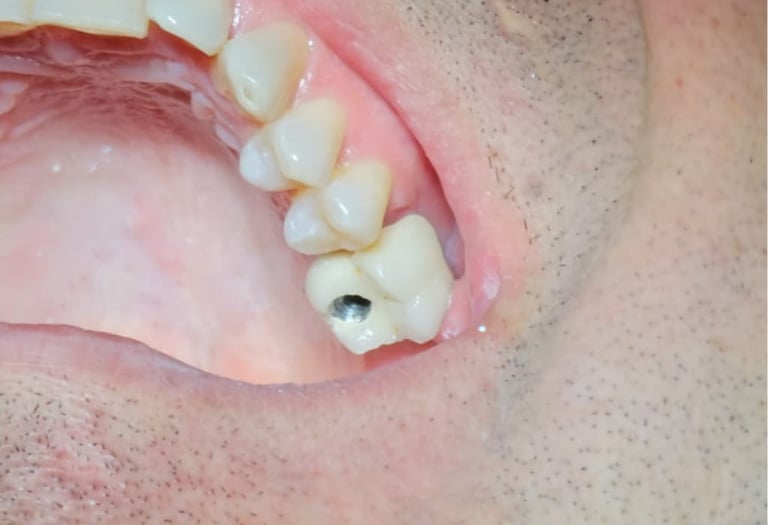 Paciente recibiendo atención odontológica en Badajoz