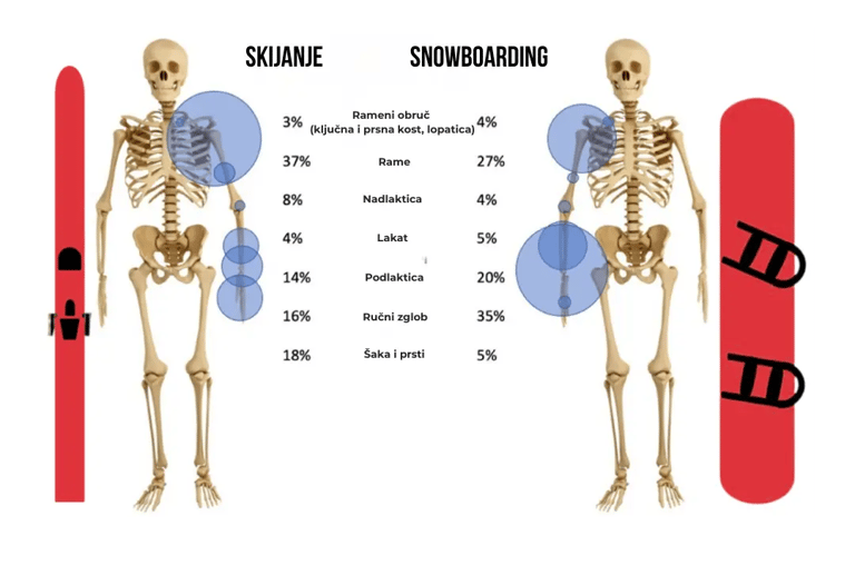 Je li opasnije skijanje ili snowboarding?
