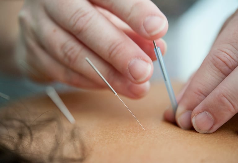 Dry needling therapy for muscle pain and trigger point release in Ballarat