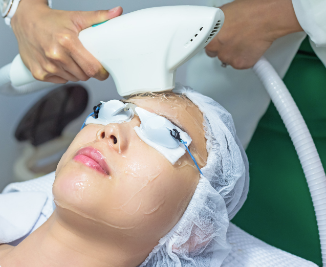 E-light rejuvenecimiento facial