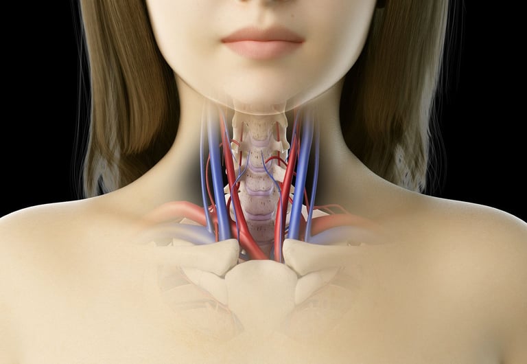 vascular ultrasound artery atherosclerosis stenosis disease stent carotid doppler stroke tia vision dizziness headache plaque
