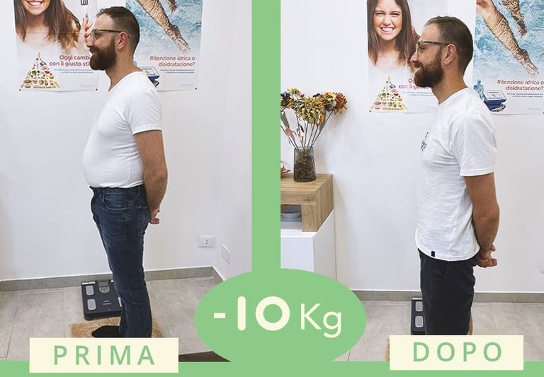 "Trasformazione fisica prima e dopo il percorso nutrizionale con perdita di 10 kg"