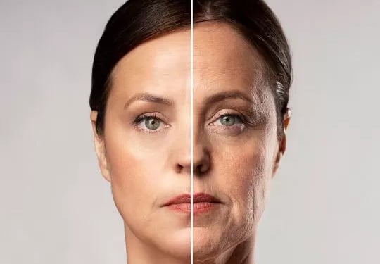 Profhilo: tratamento inovador para hidratação profunda e firmeza da pele na clínica estética em Setú
