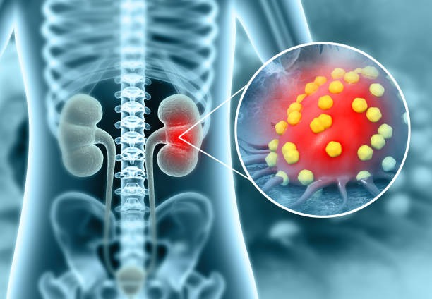 KIDNEY