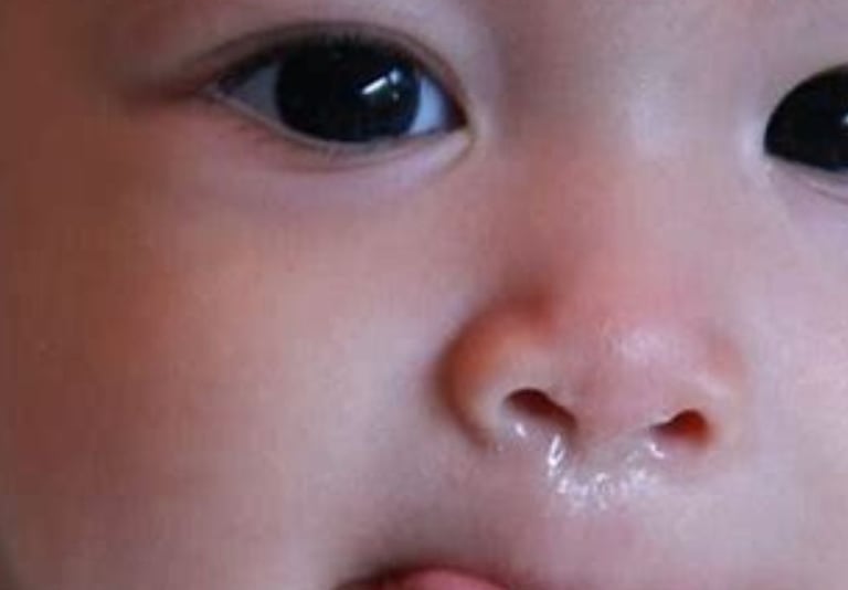 discharge nose